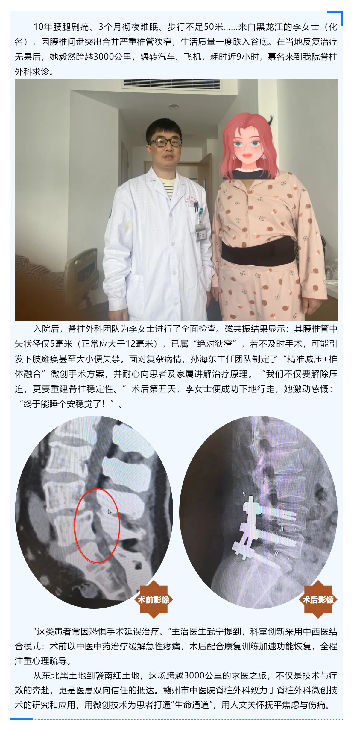 跨越山河的信任_贛州市中醫(yī)院巧手“疏堵”，腰椎狹窄患者3000公里求醫(yī)路終迎新生！.png